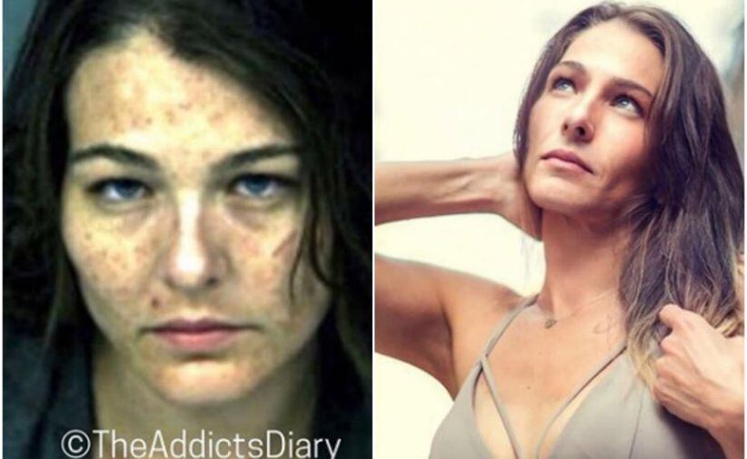Luego de que las drogas llevaron a esta chica a ser arrestada cuando tenía 28 años, decidió darle la vuelta a su vida. Ahora, trabaja como consejera de adicciones. “Estaré por siempre agradecida de tener otra oportunidad”, señala. (Foto: The Addict’s Diary)