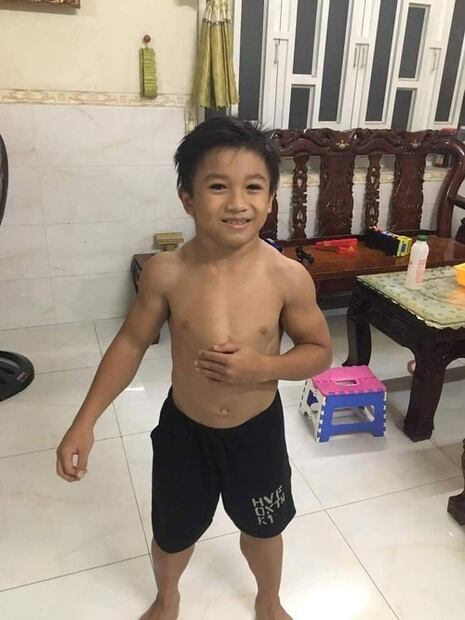 ¡Niño musculoso! Parece fisicoculturista por una rara enfermedad