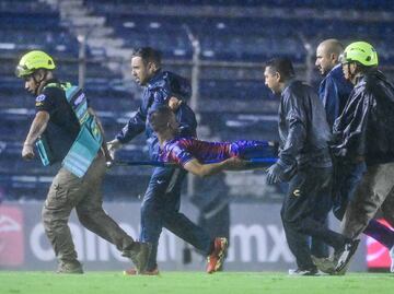 Hobbit Bermúdez: revelan cómo quedó la pierna del jugador tras fuerte lesión que le provocaron