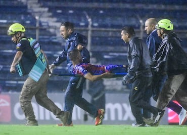 Hobbit Bermúdez: revelan cómo quedó la pierna del jugador tras fuerte lesión que le provocaron