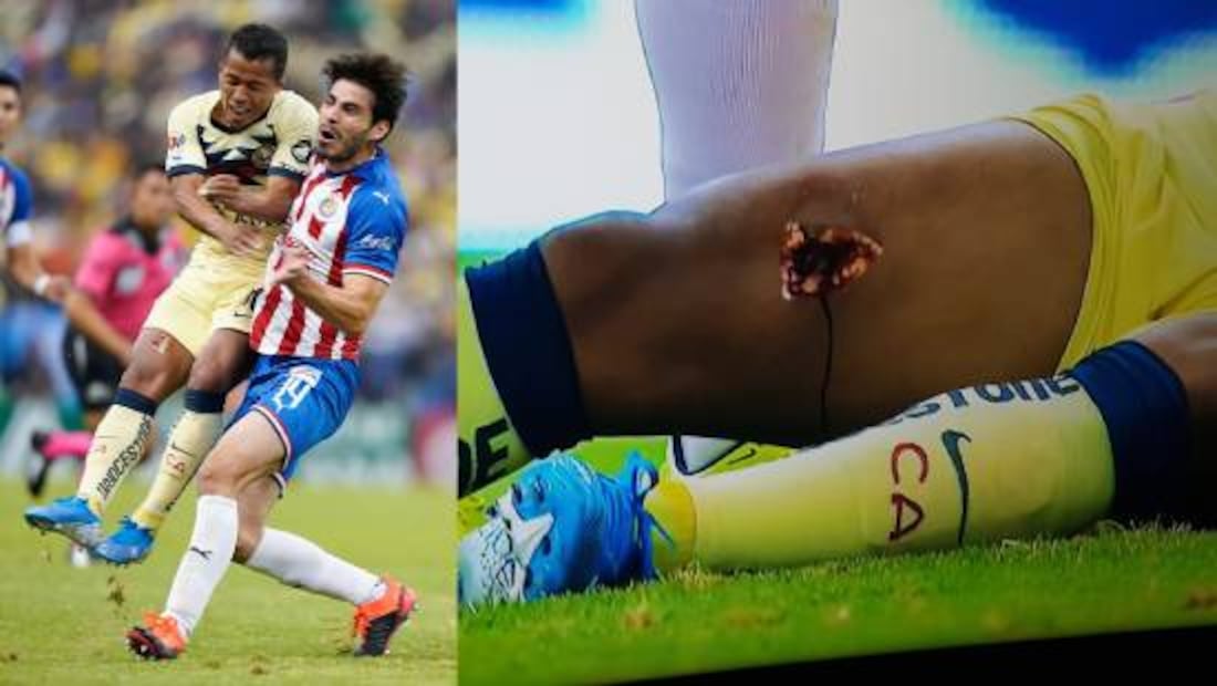 Pollo Briseño lesionó a Giovani dos Santos durante un América vs Chivas en 2019. Foto: Especial