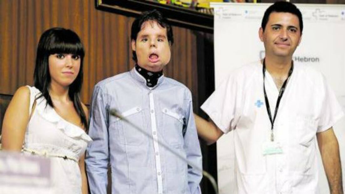 10 cirugías que revolucionaron el mundo de la medicina