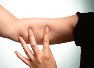 10 básicos que debes conocer sobre el implante subdérmico