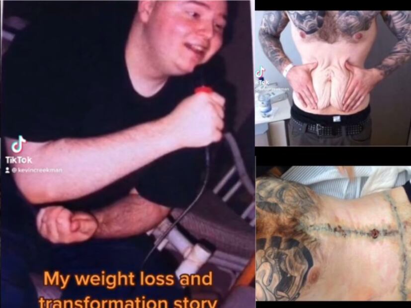 Kevin Creekman, el hombre que pesaba más de 150kg y ahora es modelo