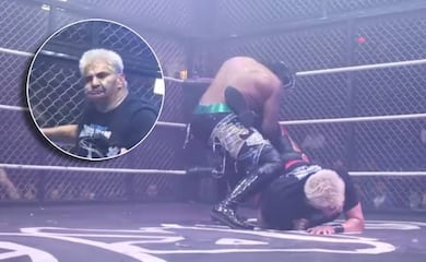 Shocker: El Mil por Ciento Guapo sufre cambió de 'look' ante el rival que le desfiguró el rostro