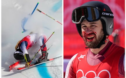 Las caídas y golpes más aparatosos de los atletas en Beijing 2022