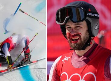 Las caídas y golpes más aparatosos de los atletas en Beijing 2022