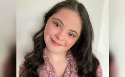 Ellie, la modelo de Gucci con síndrome de Down