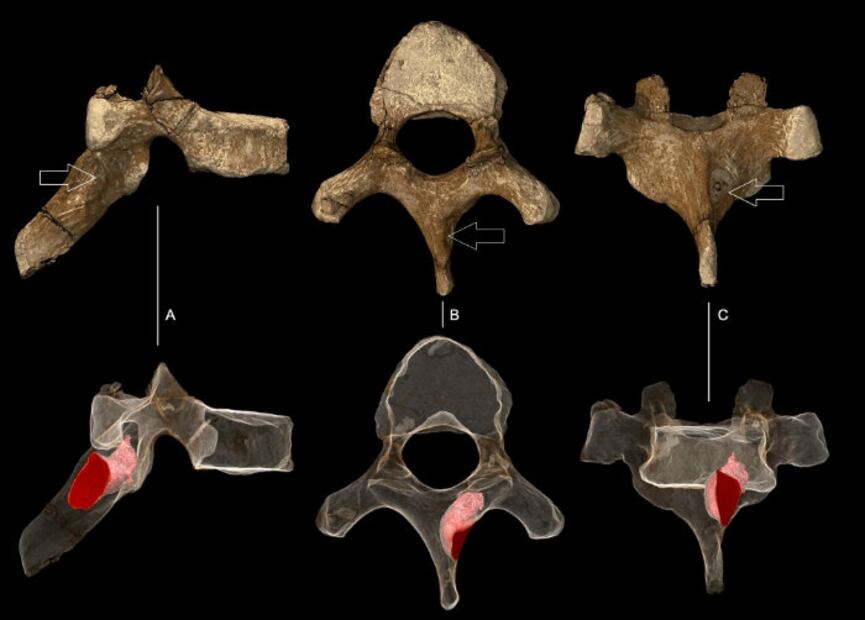 10 datos históricos para entender el origen del cáncer