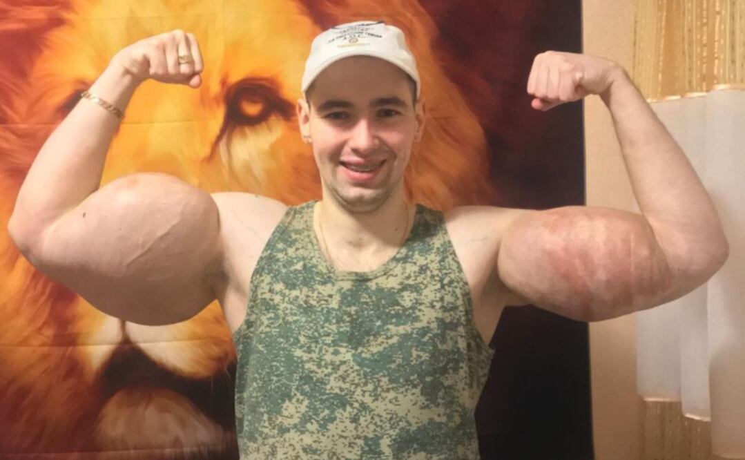 Foto: Instagram @ruki_bazuki_official