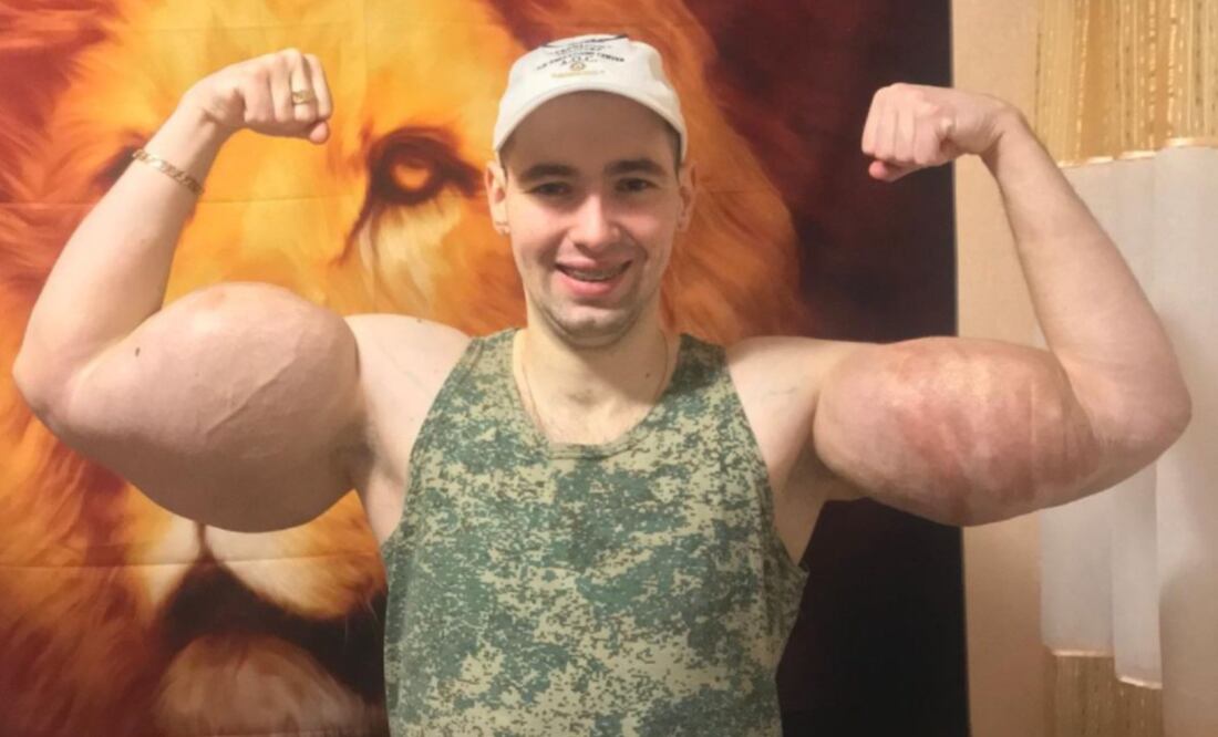 Foto: Instagram @ruki_bazuki_official