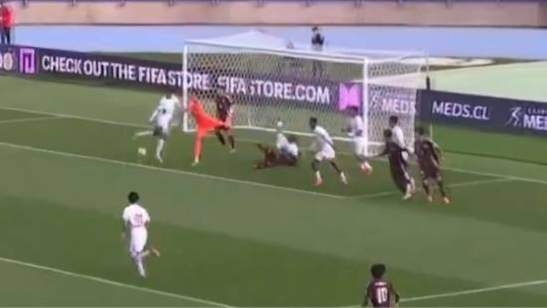 Un jugador de Marruecos le cayó en la cabeza a Mateo Ley y le provocó una conmoción. Foto: Especial