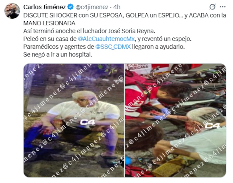 Shocker sufre lesión en la mano tras un altercado con su pareja. FOTO: Captura