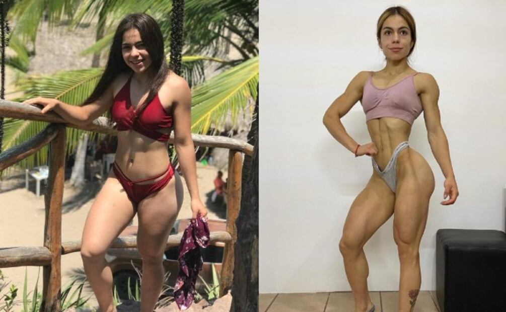 La deportista Odalis Santos muere tras aceptar tratamiento de belleza