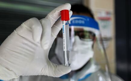 Los daños que podrían tener los asintomáticos de Covid-19