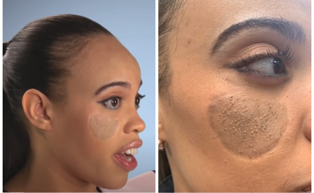 Foto: Evolution Media