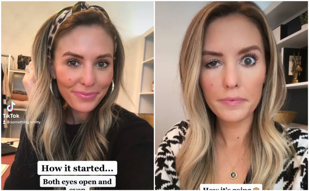 Foto: Instagram @somethingwhitty