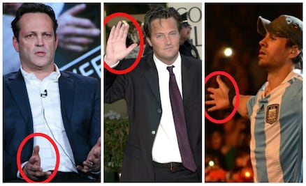 10 famosos que sufrieron la amputación de una parte de su cuerpo