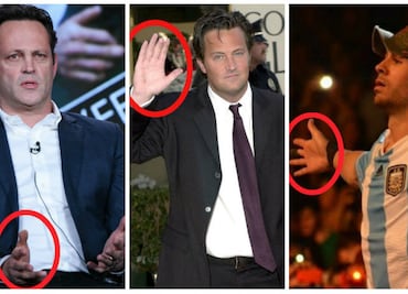 10 famosos que sufrieron la amputación de una parte de su cuerpo