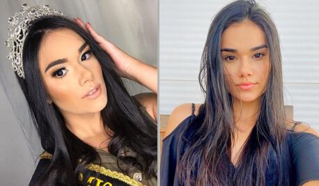 Muere reina de belleza de 21 años durante cirugía en Brasil