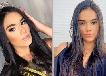 Muere reina de belleza de 21 años durante cirugía en Brasil