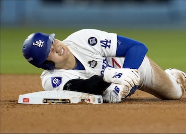 Shohei Ohtani enciende las alarmas entre los Dodgers tras lesionarse en el segundo juego vs Yankees