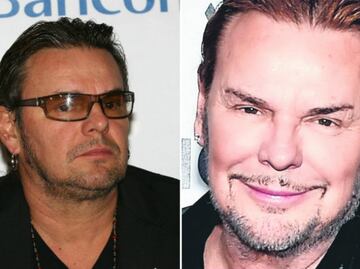 10 famosos mexicanos que abusaron de las cirugías