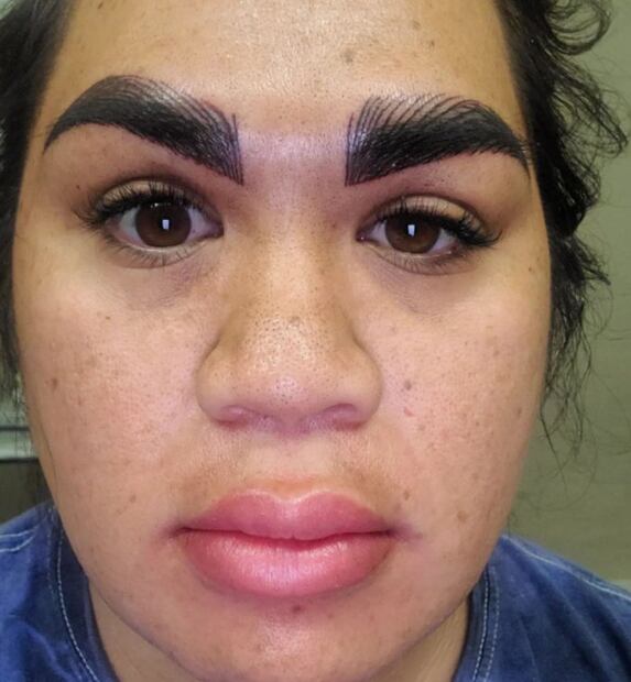 Mujer pagó 7 mil pesos por microblading y le arruinaron la cara