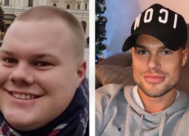 Este hombre gastó más de 30 mil dólares para lucir “perfecto”