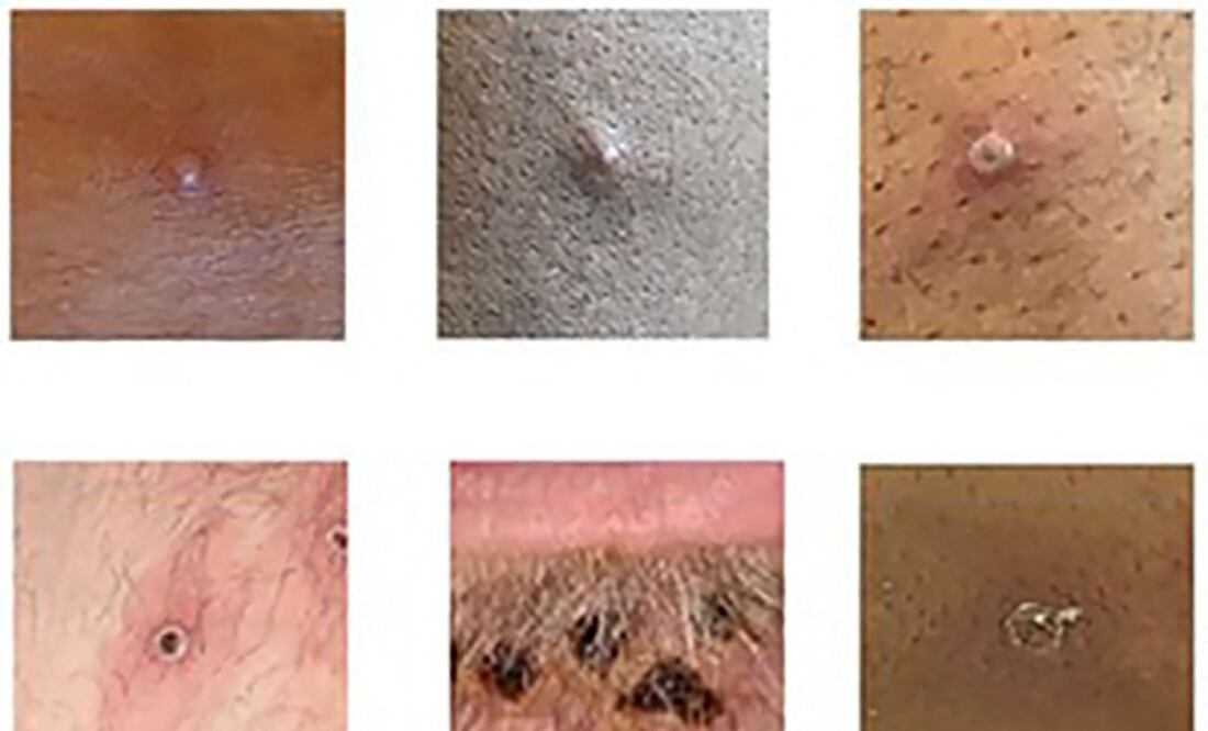 Foto: Handout / UK Health Security Agency / AFP