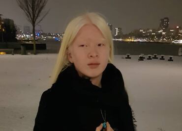 Xueli, la modelo Vogue que fue abandonada de bebé por ser albina