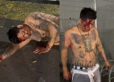 América vs Toluca: Aficionado azulcrema recibió brutal golpiza en el Estadio Azteca