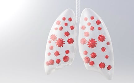¿Qué pasa en los pulmones cuando hay infección por Covid-19?