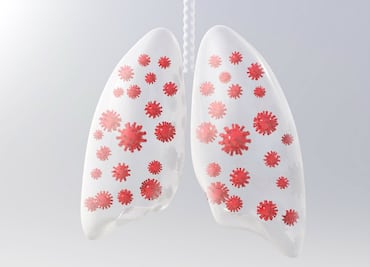 ¿Qué pasa en los pulmones cuando hay infección por Covid-19?