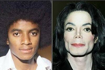 Michael Jackson, así se desvaneció el color de su piel