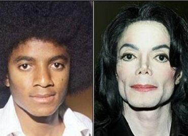 Michael Jackson, así se desvaneció el color de su piel