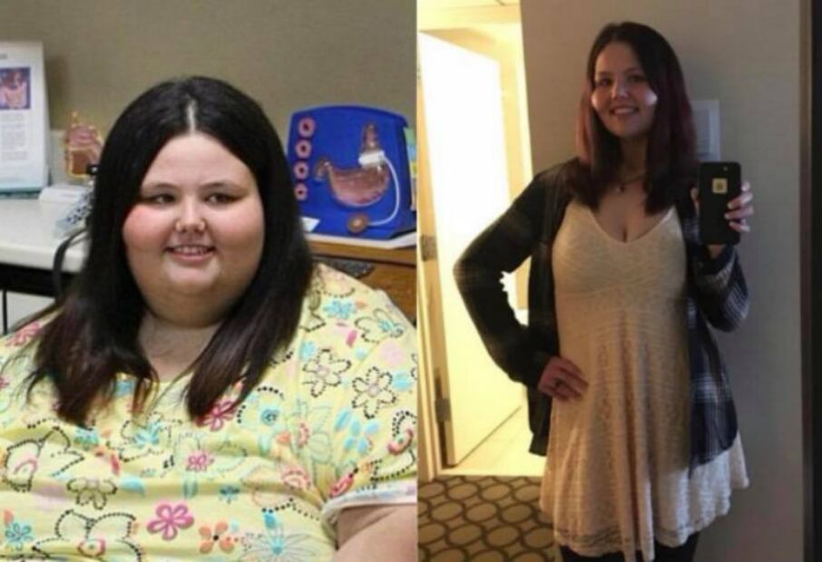 10 casos extremos de personas con obesidad que lograron bajar de peso