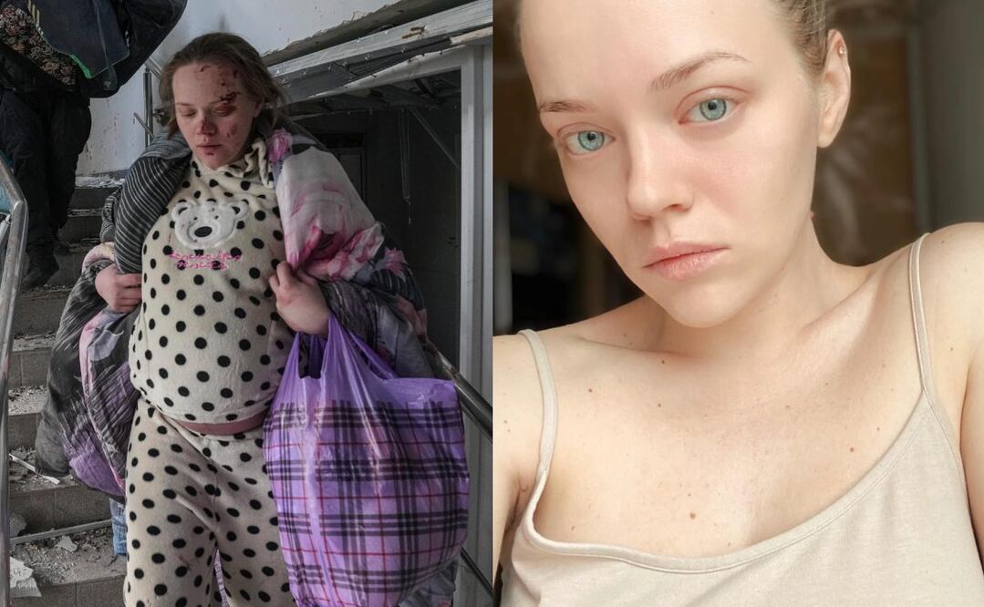 Foto: AP Evgeniy Maloletka / Instagram @gixie_beauty