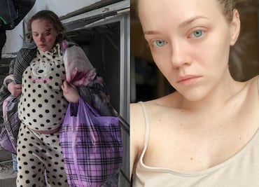 Rusia acusa a Ucrania de contratar actrices para posar en el hospital infantil bombardeado