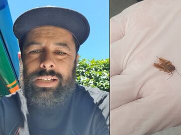 Fue al médico por una molestia en el oído… ¡y le sacaron una cucaracha!