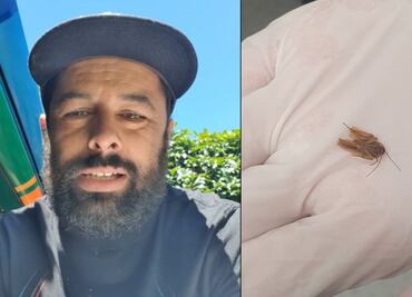 Fue al médico por una molestia en el oído… ¡y le sacaron una cucaracha!