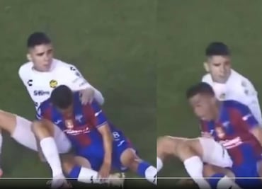 Hobbit Bermúdez: así fue su reacción cuando se dio cuenta de que Luis Ruiz lo había fracturado