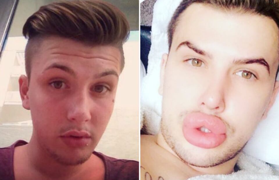 James Holt, el chico que quiere lucir como Kylie Jenner