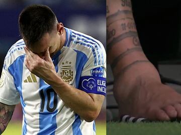 Cómo se encuentra la lesión en el tobillo de Lionel Messi