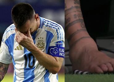 Cómo se encuentra la lesión en el tobillo de Lionel Messi