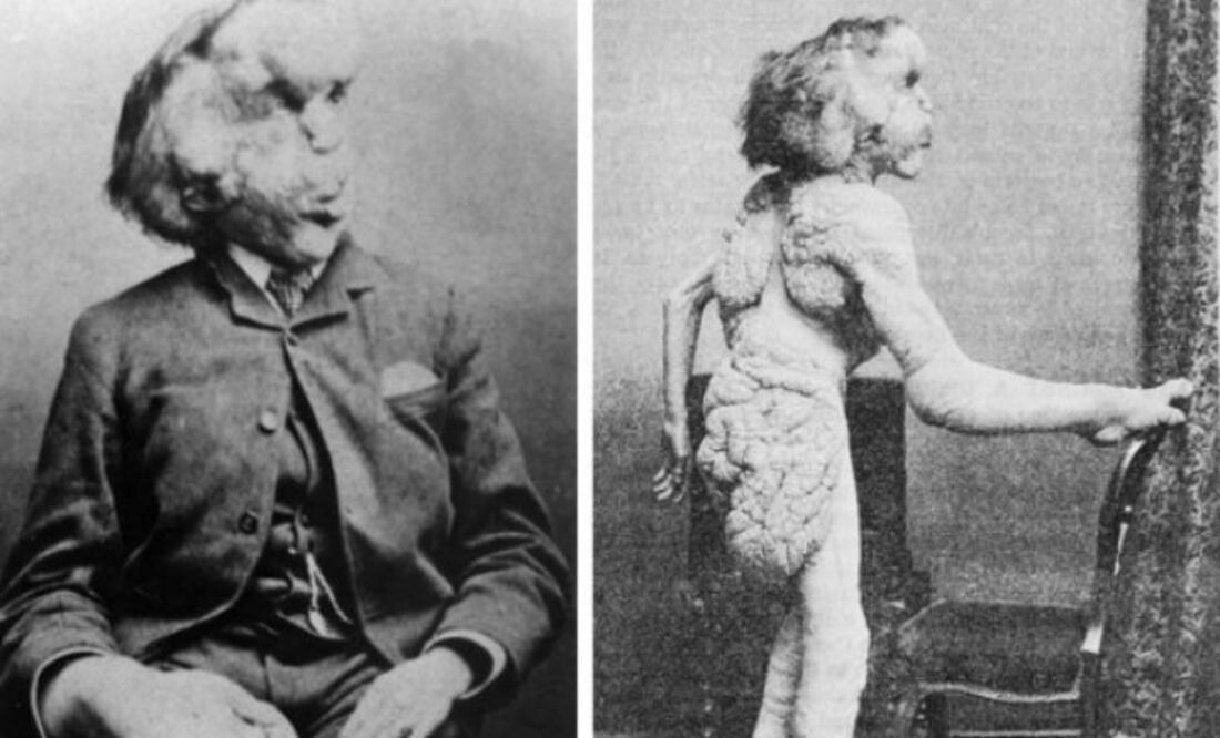 Fotos: Wikipedia Commons