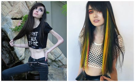 5 influencers que padecieron trastornos alimenticios y ¡los han superado! 