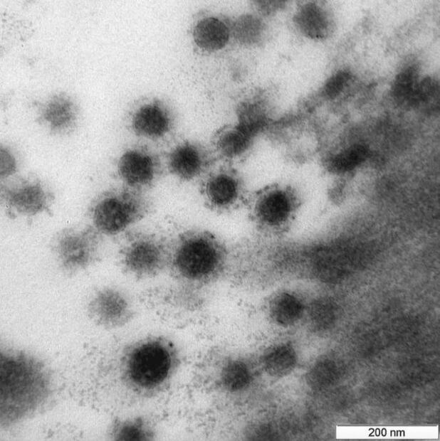 Así se ve la cepa de la variante Delta de Covid en un microscopio