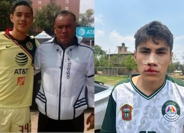Exhiben a papá de Emilio Lara por presuntamente golpear a menor de edad en torneo amateur