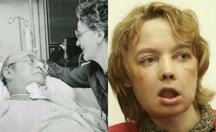 10 cirugías que revolucionaron el mundo de la medicina